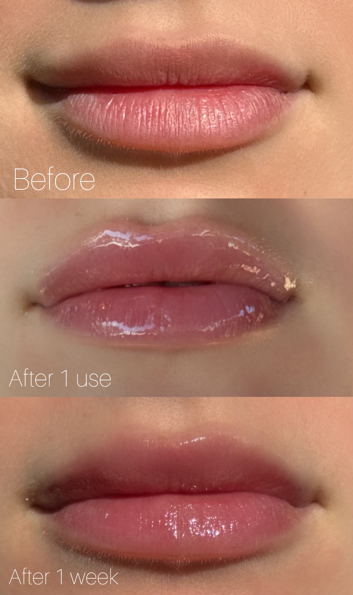 Before and after of lips after using lip plumper